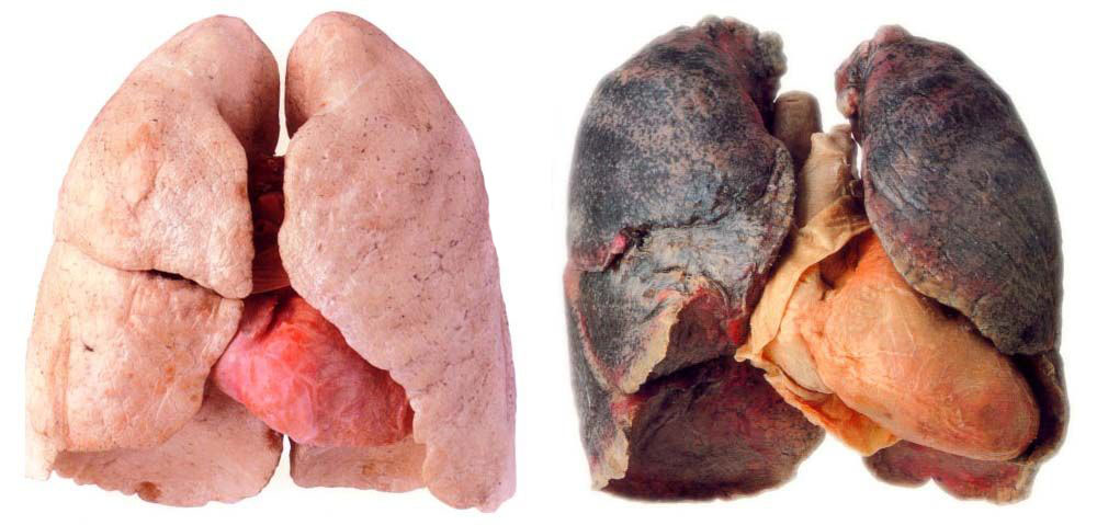 Cilia Lungs